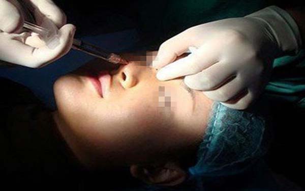 北京玻尿酸填充医院推荐，北京伊美康玻尿酸隆鼻案例|价格