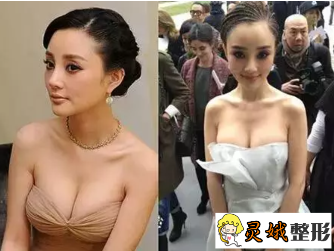 李小璐隆胸之李小璐从a到e胸部比脸大,简直美不胜收