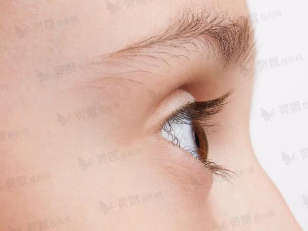 纳米微创双眼皮恢复期的影响因素