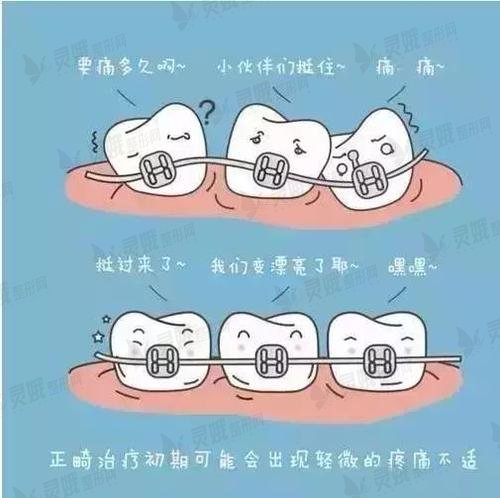 牙齿矫正可能会产生的危害