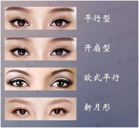 徐州李雪阳医生教你如何挑选双眼皮类型