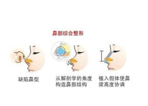 鼻部手术2.jpg